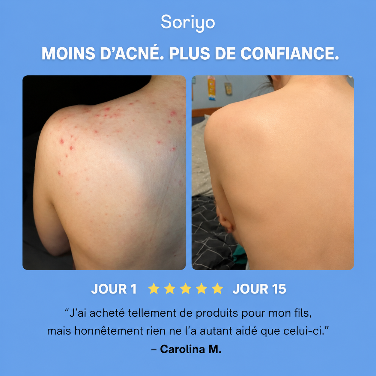 Savon Purifiant Anti-Acné™