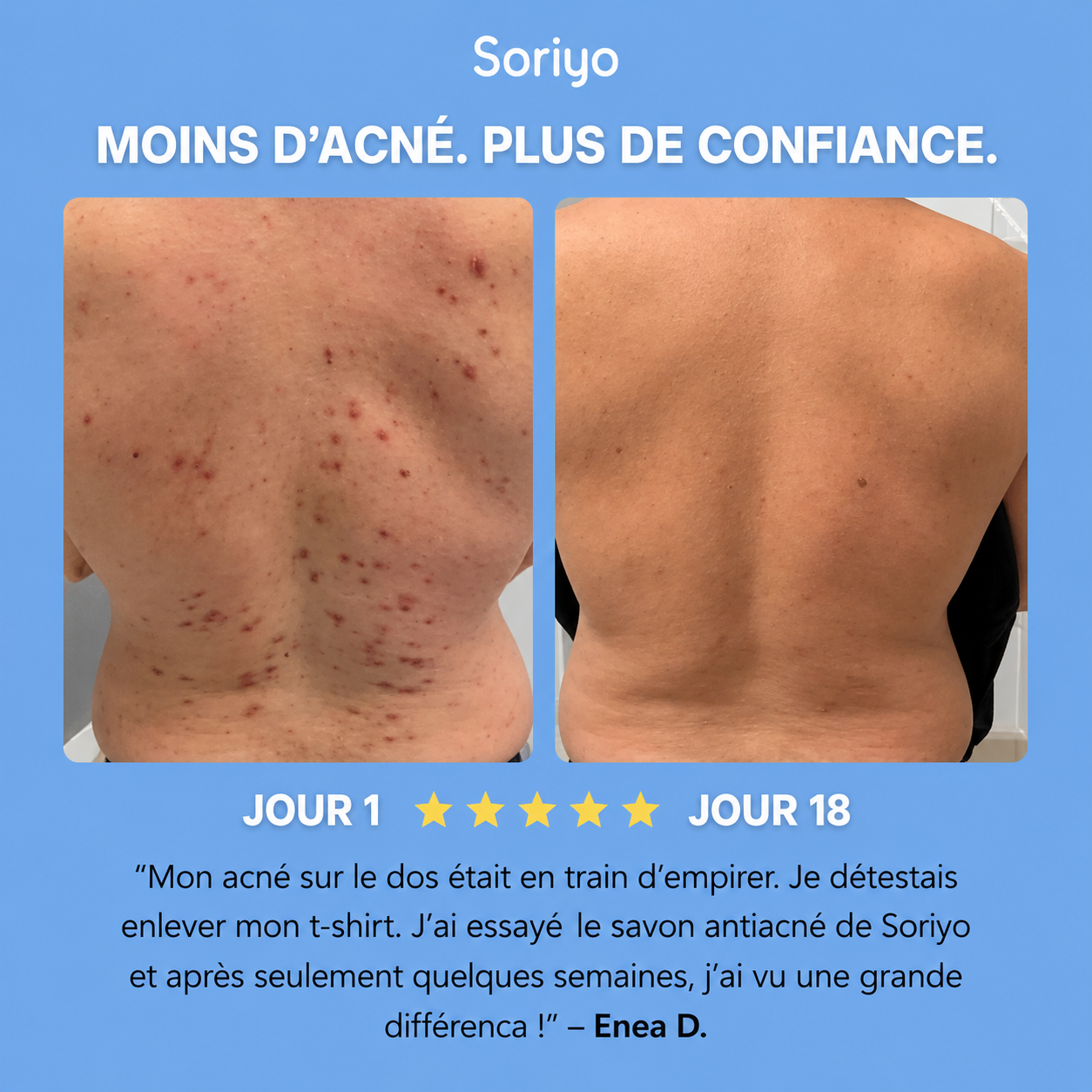 Savon Purifiant Anti-Acné™
