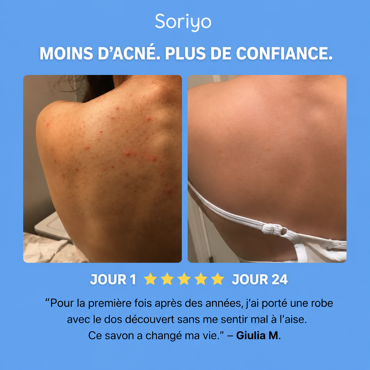 Savon Purifiant Anti-Acné™