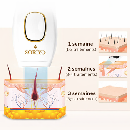 Soriyo SilkGlow™ IPL
