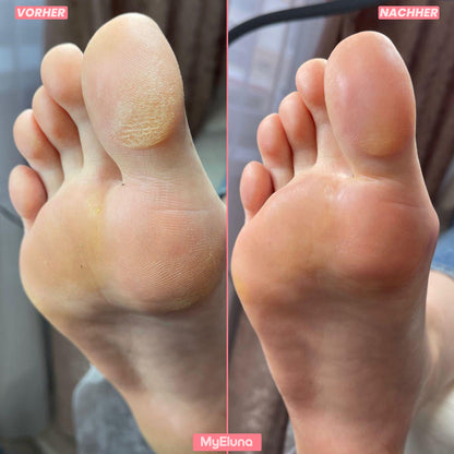 FootGlow™
