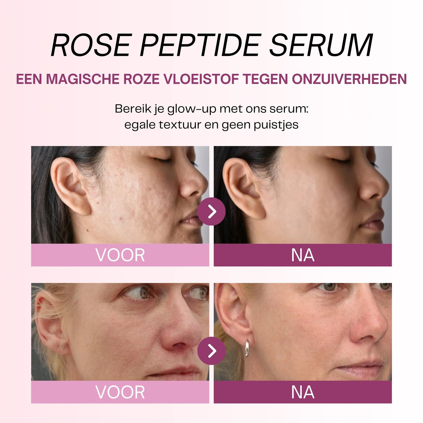 Sérum Peptide PDRN