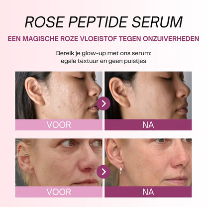 Sérum Peptide PDRN