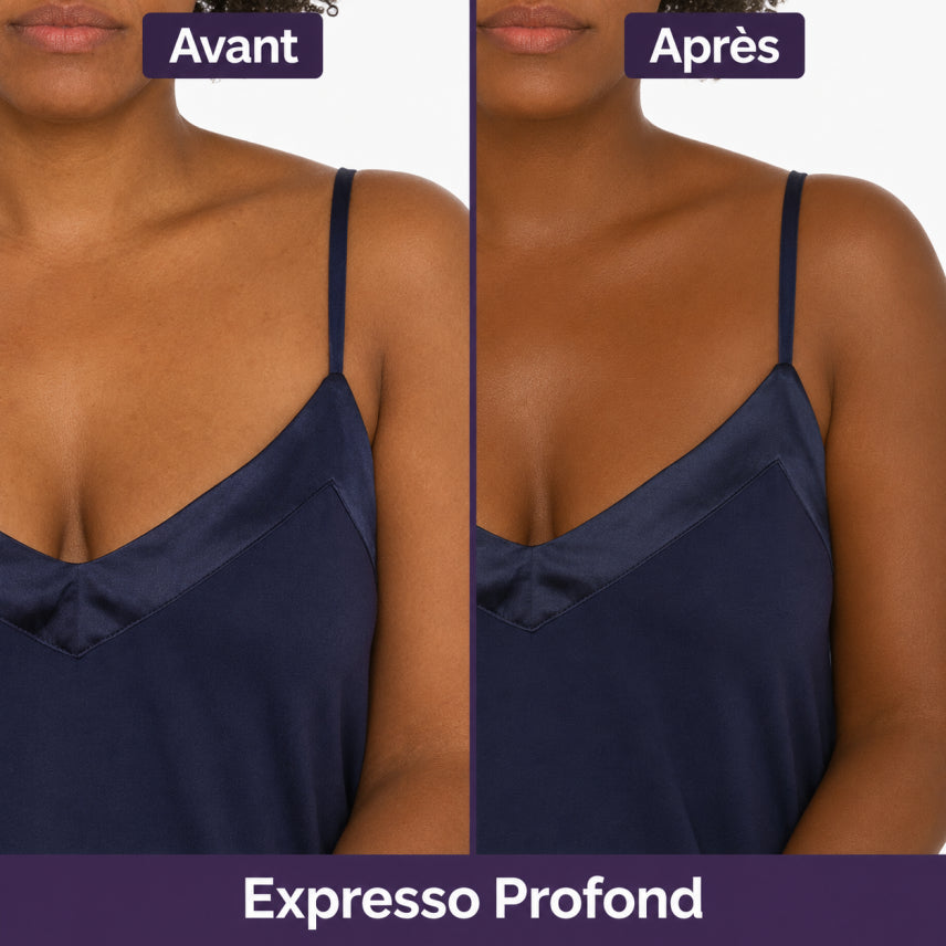 Soriyo™ – Une Peau Sans Imperfections