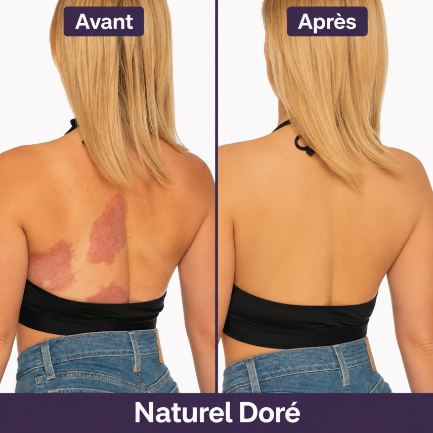 Soriyo™ – Une Peau Sans Imperfections