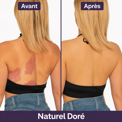 Soriyo™ – Une Peau Sans Imperfections