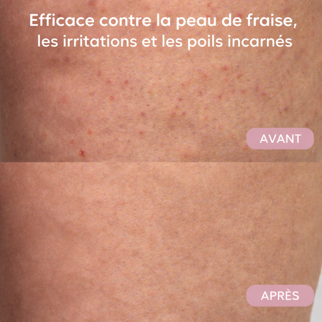 Rasoir Doux et Sans Douleur pour Femmes