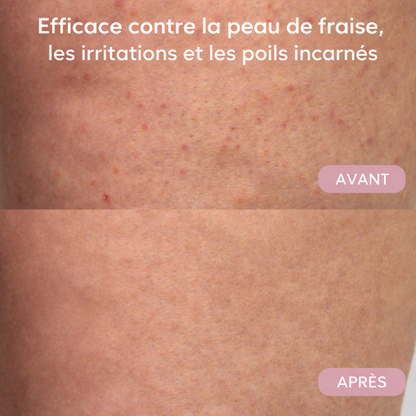 Rasoir Doux et Sans Douleur pour Femmes