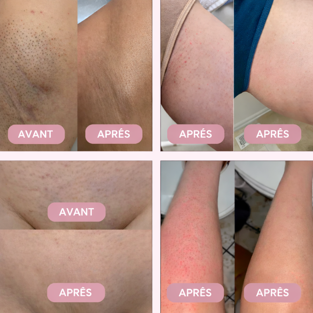 Rasoir Doux et Sans Douleur pour Femmes