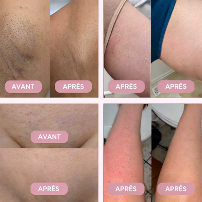 Rasoir Doux et Sans Douleur pour Femmes