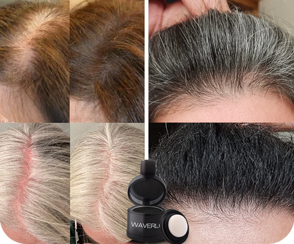 Soriyo™ – Poudre densifiante pour cheveux clairsemés